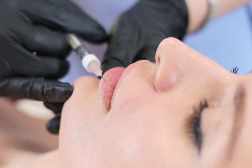 Natural lip filler enhancement at Aterna Wellness