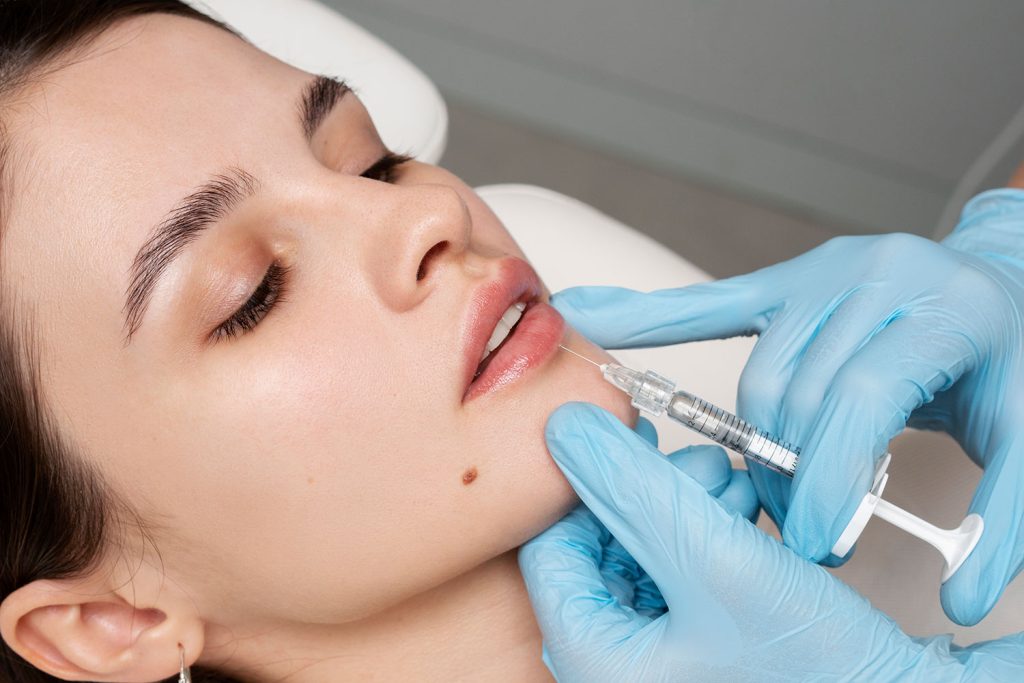 Lip filler treatment for fuller lips at Aterna Wellness